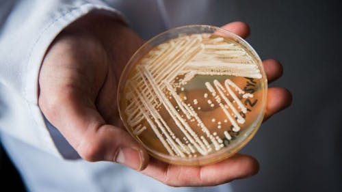 Candida auris, a potentially lethal fungus, is affecting health care facilities and at-risk patients internationally. – Photo by @FOX2News / Twitter