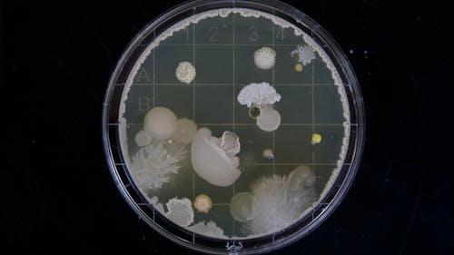"The Invisible Extinction," a new documentary, features two Rutgers professors and their research on the microbiome. – Photo by Michael Schiffer / Unsplash